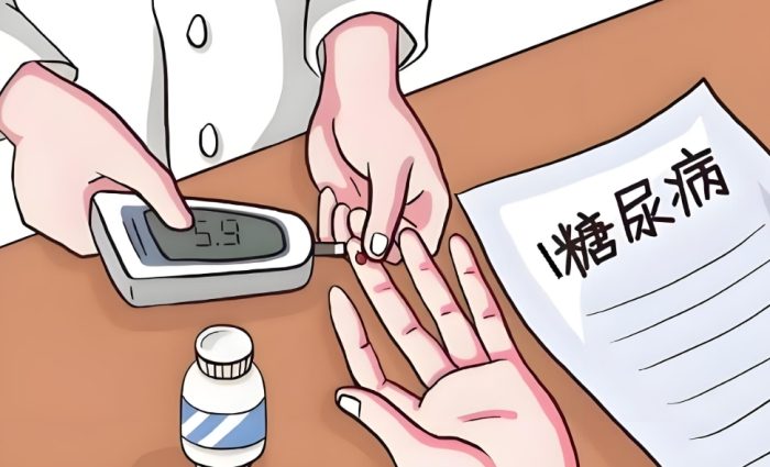 第一型糖尿病第二型糖尿病差別 第一型糖尿病第二型糖尿病差別