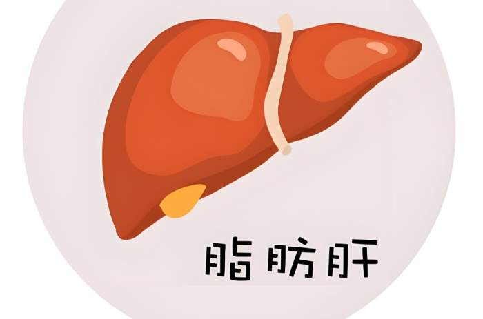 脂肪肝風險因素 脂肪肝風險因素
