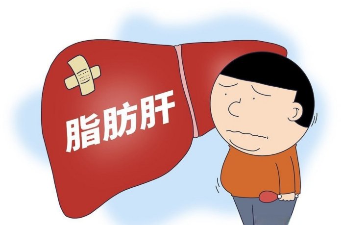 脂肪 肝