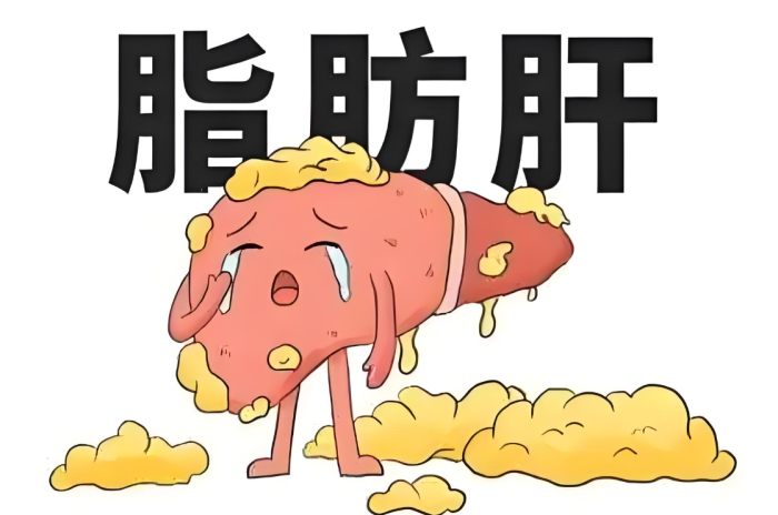 脂肪肝原因 脂肪肝原因