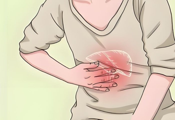 輕度脂肪肝症狀 輕度脂肪肝症狀