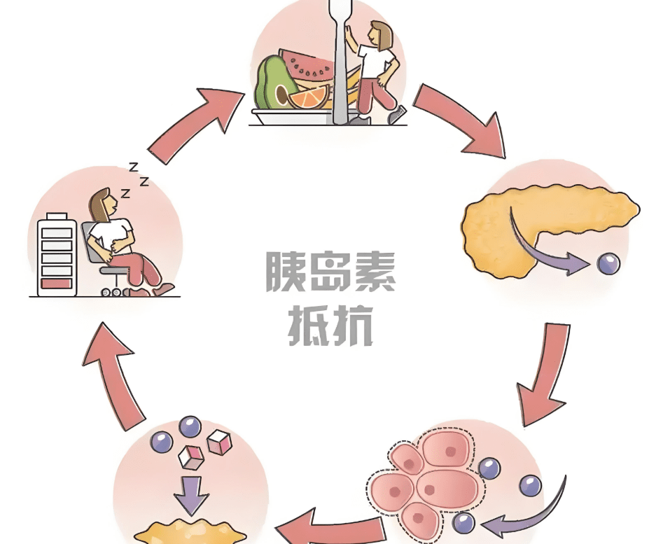 胰島素 阻抗 症狀
