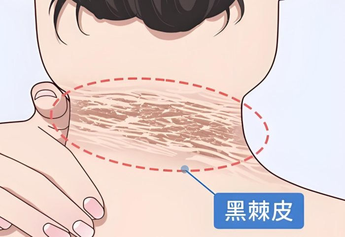 皮膚發癢與疼痛 皮膚發癢與疼痛